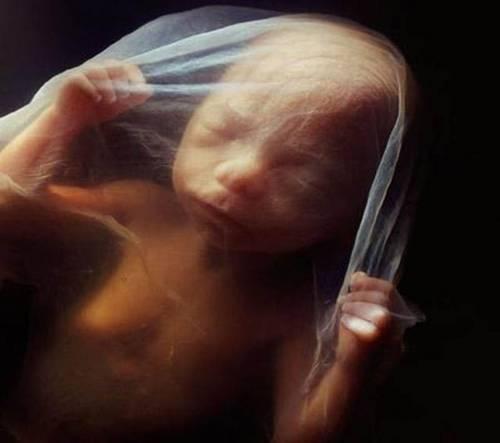 La 18 saptamani,fetusul are aproximativ 14 cm. Poate percepe sunete din mediul exterior .
