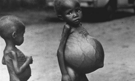 Biafran-CHILDREN-STARVING