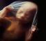 La 18 saptamani,fetusul are aproximativ 14 cm. Poate percepe sunete din mediul exterior .