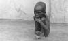 A-starving-Biafran-child